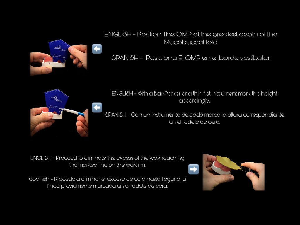 OMP OCCLUSAL TEMPLATE