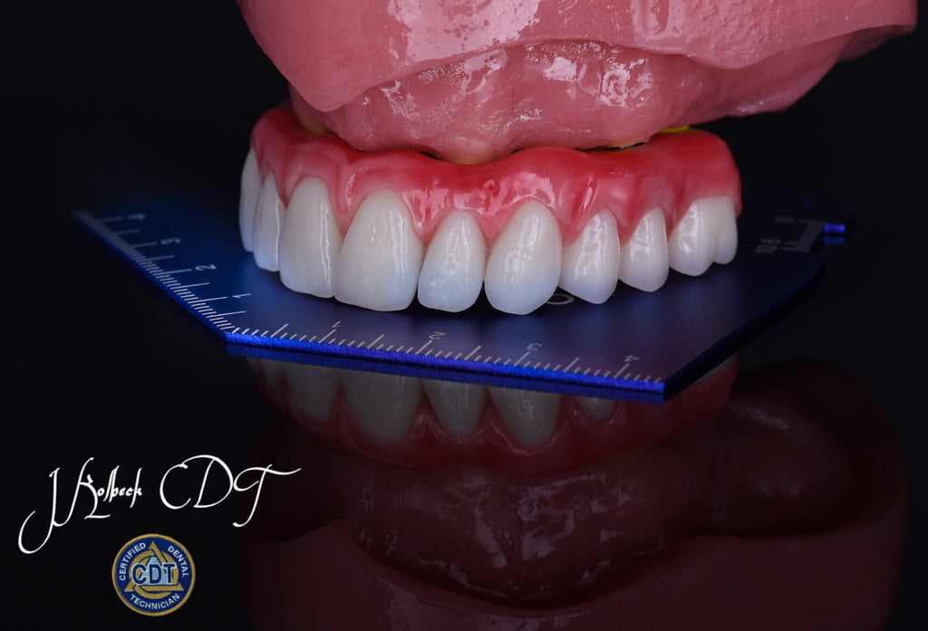 OMP OCCLUSAL TEMPLATE