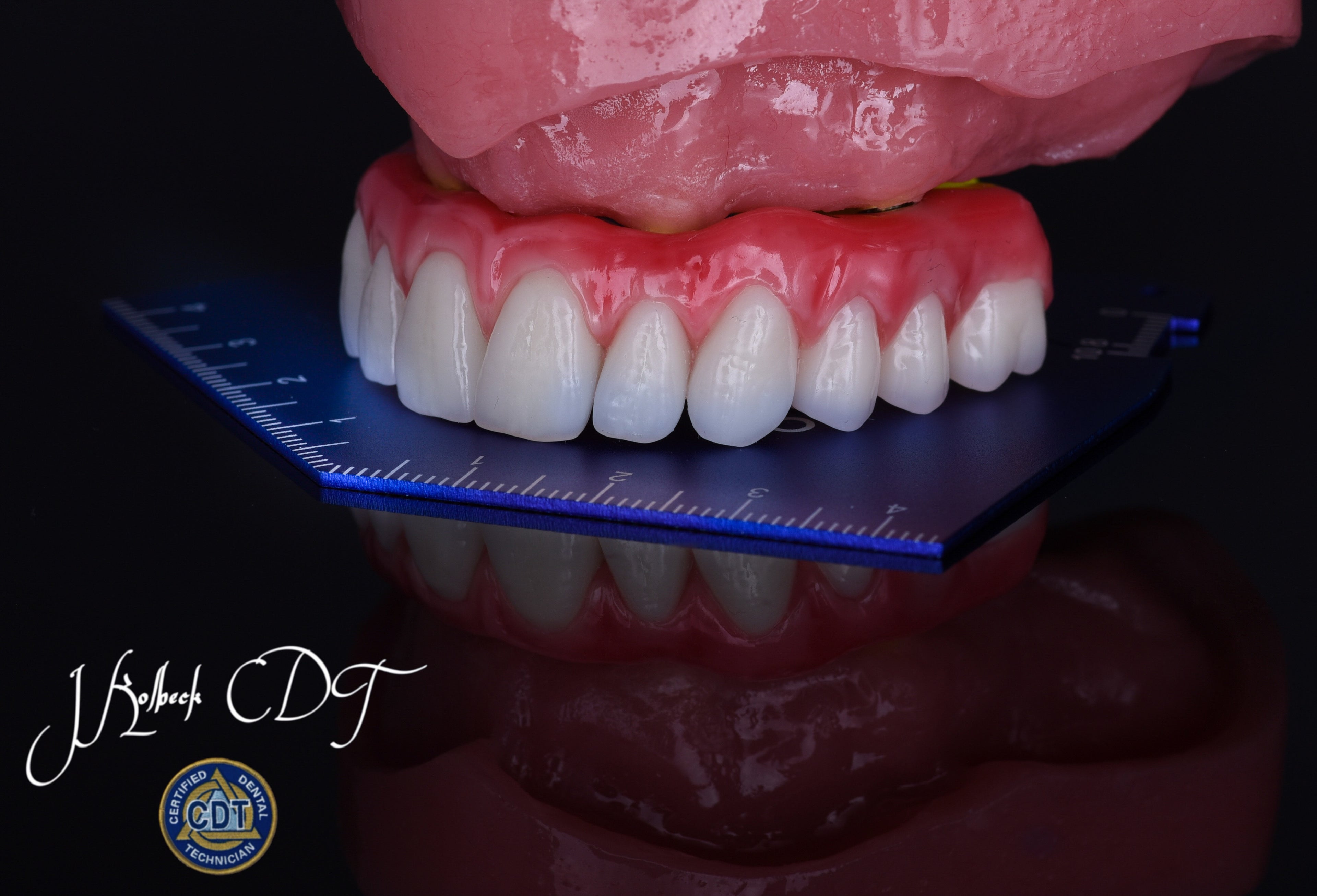 OMP OCCLUSAL TEMPLATE