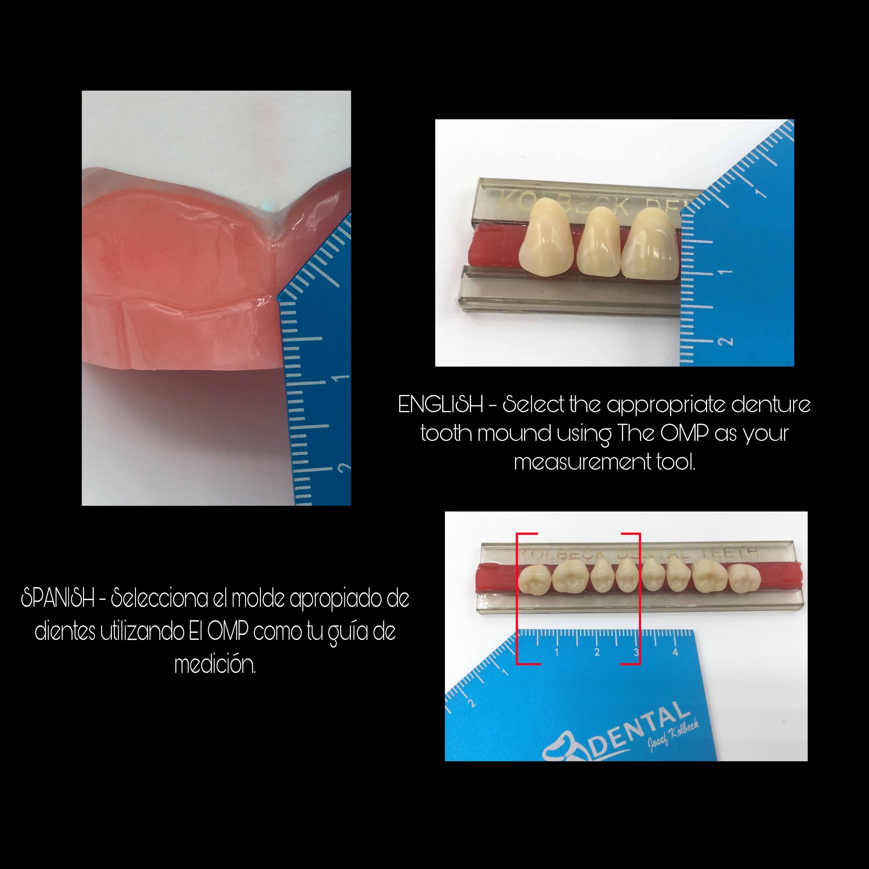 OMP OCCLUSAL TEMPLATE