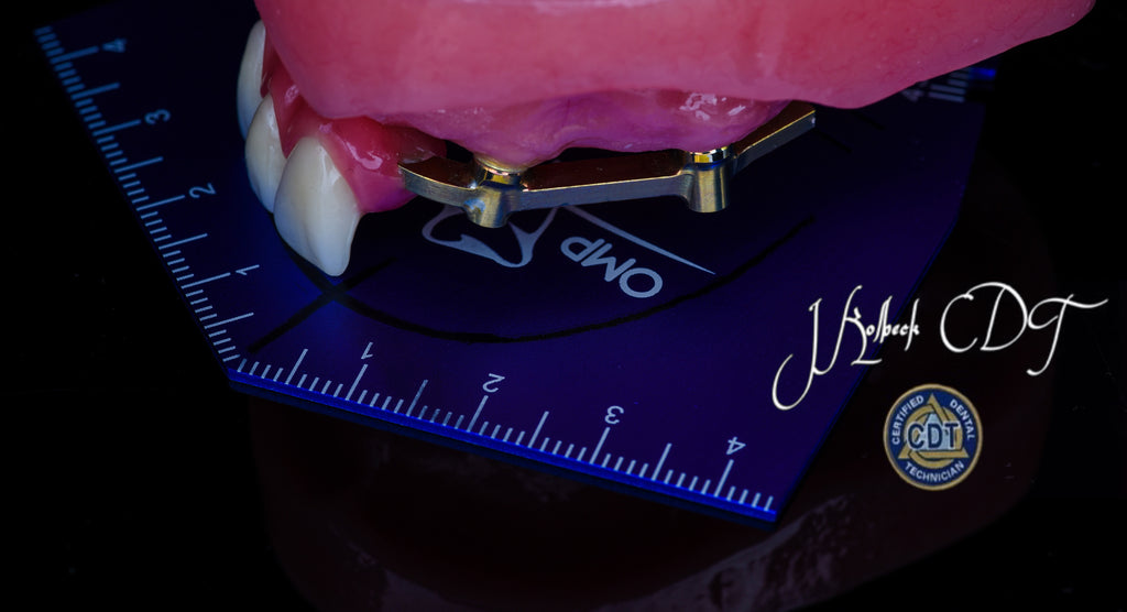 OMP OCCLUSAL TEMPLATE
