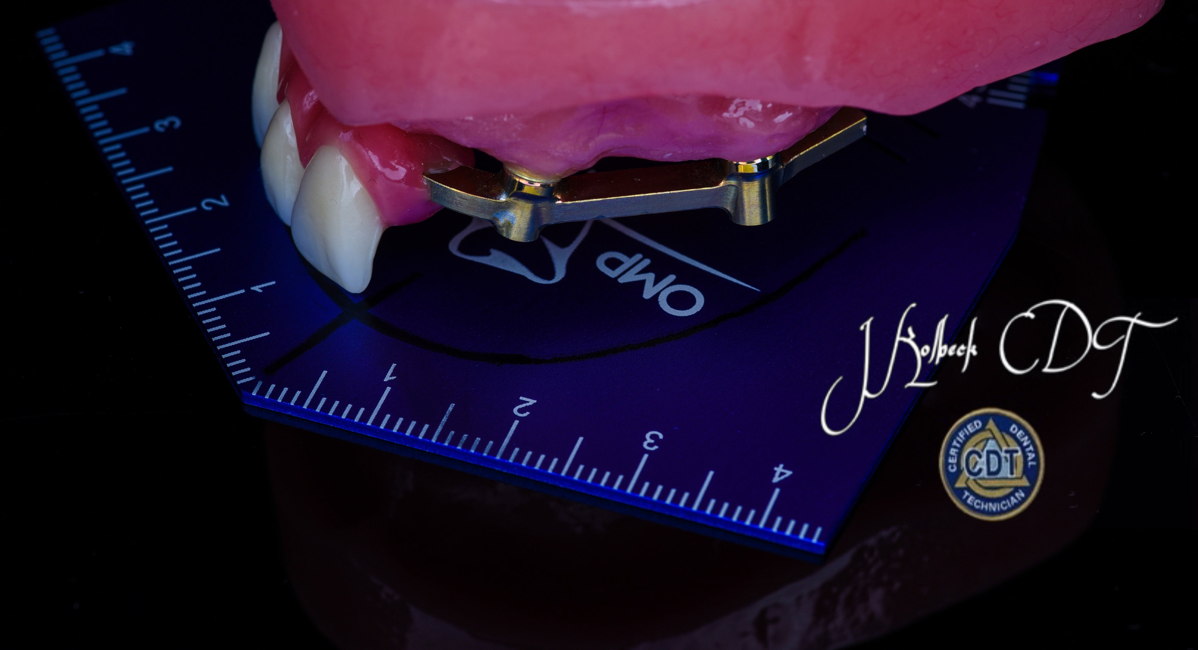 OMP OCCLUSAL TEMPLATE