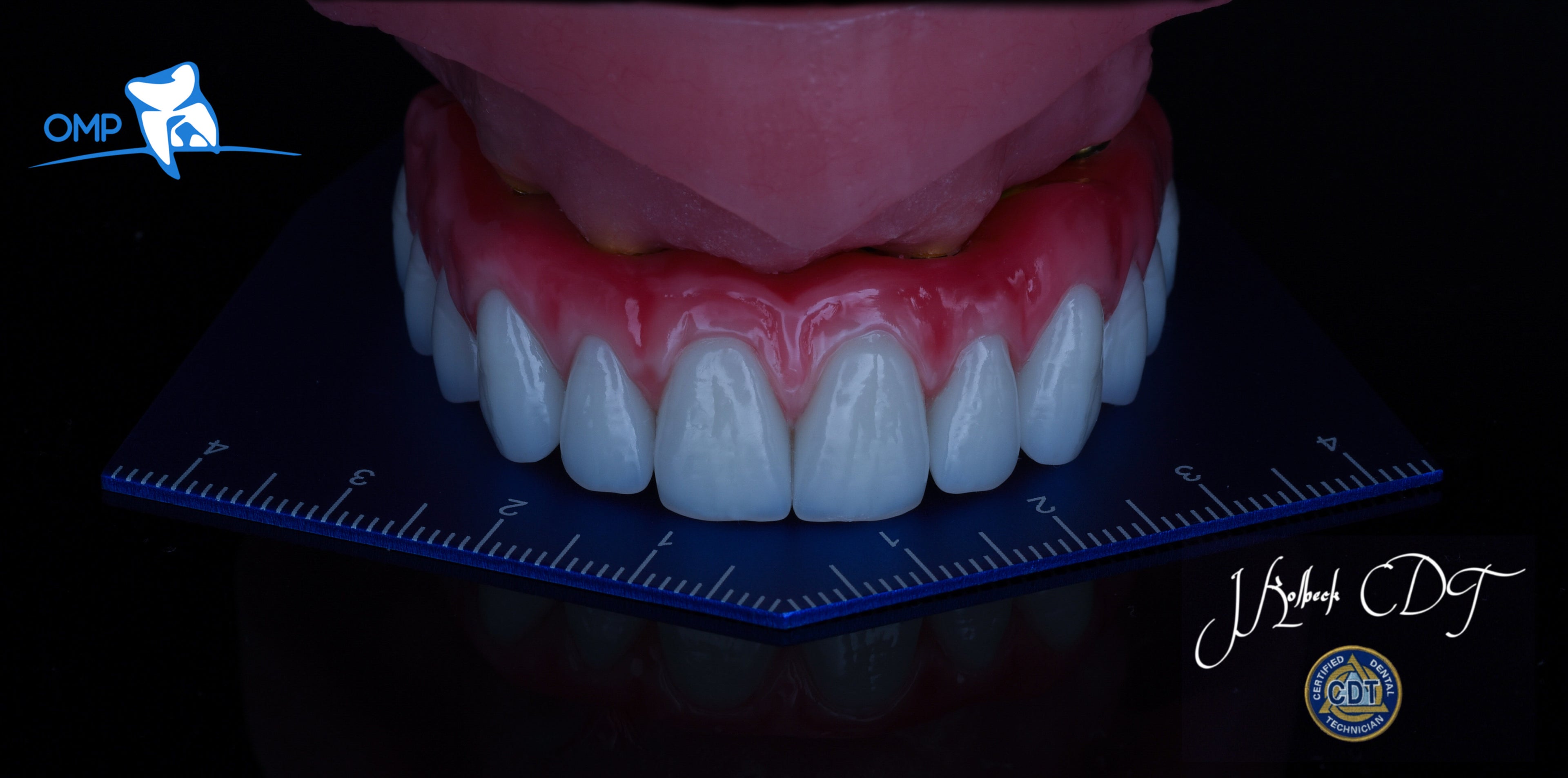 OMP OCCLUSAL TEMPLATE